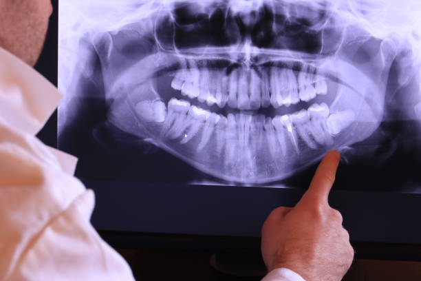 Best 24-Hour Emergency Dentist in Svis, IL