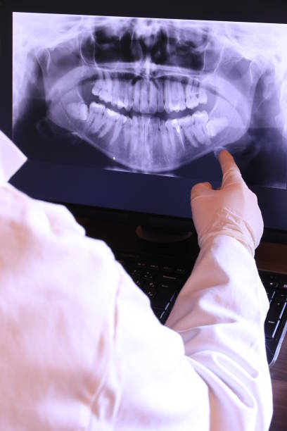 Best Emergency Root Canal Treatment in Svis, IL