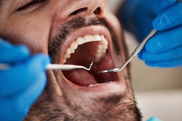 Best Emergency Dental Services for Seniors in Svis, IL