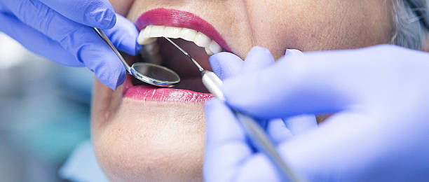 Best Urgent Dental Care for Toothache in Svis, IL
